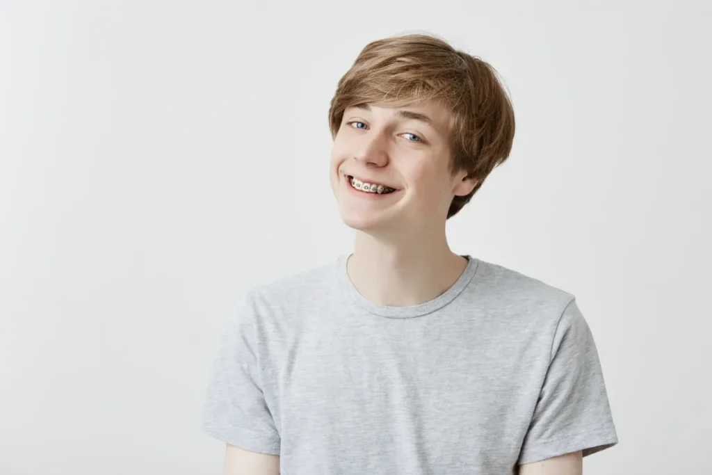 HOW LONG DO BRACES TAKE TO STRAIGHTEN TEETH?