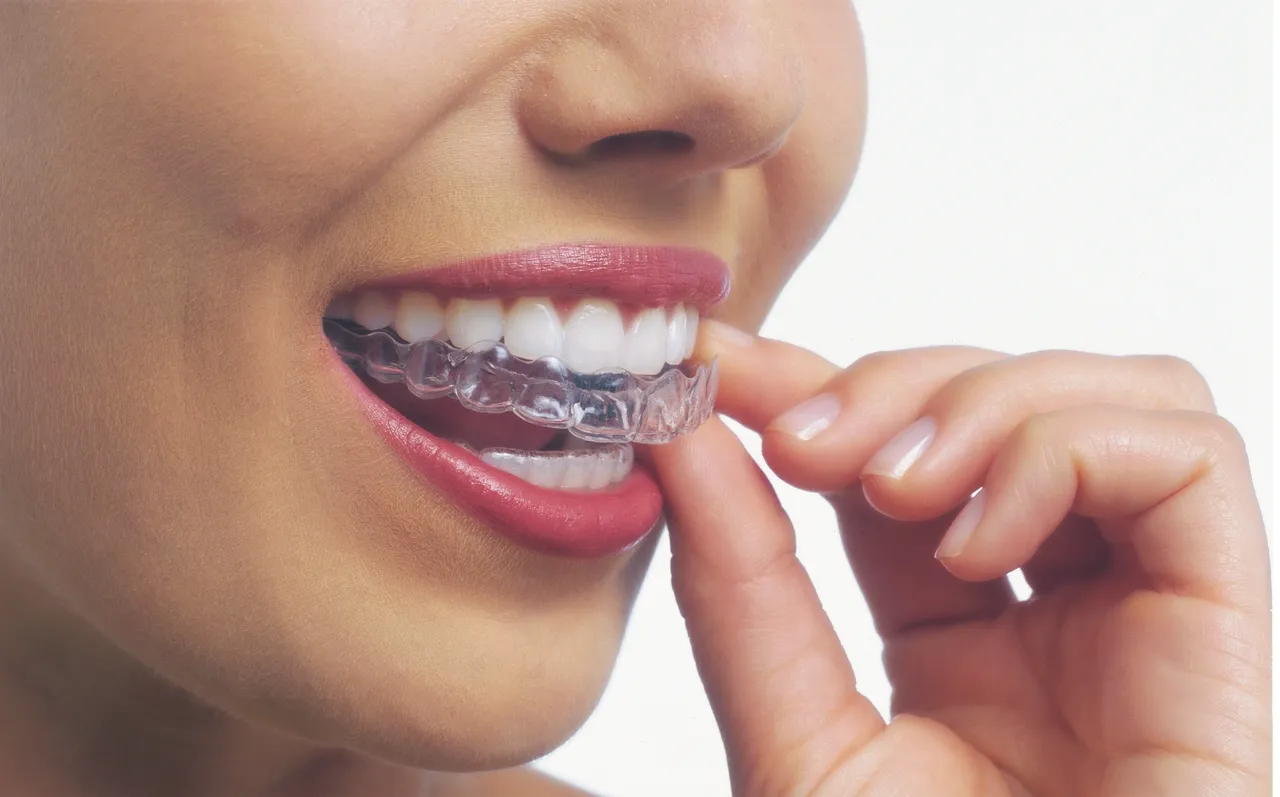 Tips to Maximize the Effects of Invisalign